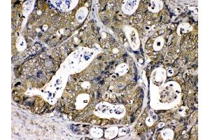 IHC analysis of Cyclophilin A using anti- Cyclophilin A antibody .