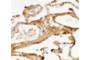 Immunohistochemistry of NIBRIN (NT) in human lung tissue with NIBRIN antibody (N-term) Cat.