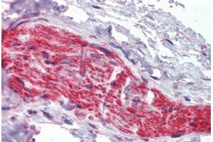 Nerve, Human: Formalin-Fixed, Paraffin-Embedded (FFPE) (Ankyrin G anticorps  (AA 1690-1701))