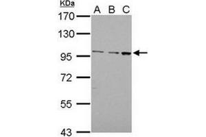 AP31133PU-N EMR1 antibody staining of Jurkat (Lane A), Raji (Lane B) and K562 (Lane C)whole cell lysates (30 µg) at 1/1000 dilution, 7.