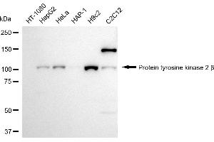 Western blotting analysis using Protein tyrosine kinase 2 beta antibody (ABIN7800063).