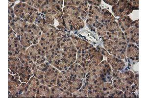 Image no. 2 for anti-Tubulin Folding Cofactor E-Like (TBCEL) antibody (ABIN1501326)