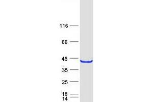 Validation with Western Blot
