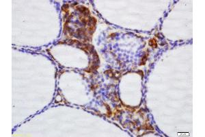 Formalin-fixed and paraffin embedded dog thyroid labeled with Rabbit Anti-NNT Polyclonal Antibody, Unconjugated (ABIN709631) at 1:200 followed by conjugation to the secondary antibody and DAB staining (NNT anticorps  (AA 981-1086))