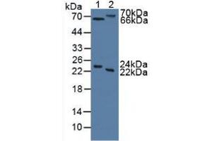 Figure. (Mannose Associated Serine Protease 2 (AA 445-683) anticorps)