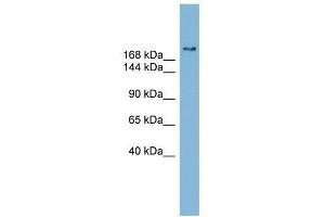 SETBP1 antibody used at 0. (SETBP1 anticorps  (Middle Region))