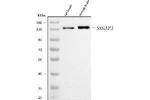 Western blot analysis of SRGAP3 using anti-SRGAP3 antibody (ABIN7602538).