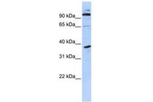 Image no. 1 for anti-PHD Finger Protein 11 (PHF11) (N-Term) antibody (ABIN6740584) (PHF11 anticorps  (N-Term))