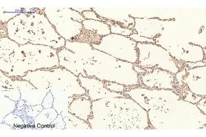 Immunohistochemical analysis of paraffin-embedded human lung tissue. (Collagen IV anticorps)