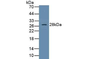 Detection of Recombinant SOCS1, Human using Polyclonal Antibody to Suppressors Of Cytokine Signaling 1 (SOCS1) (SOCS1 anticorps  (AA 1-211))
