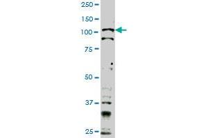 TLR9 monoclonal antibody (M02), clone 1F4 Western Blot analysis of TLR9 expression in Hela S3 NE . (TLR9 anticorps  (AA 99-215))