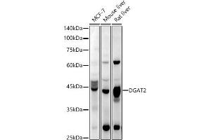 Western blot analysis of extracts of various cell lines, using DG antibody (ABIN6130268, ABIN6139559, ABIN6139561 and ABIN6218054) at 1:1000 dilution. (DGAT2 anticorps  (AA 113-388))