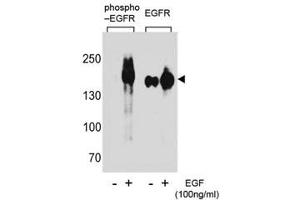 Western blot analysis of extracts from A431 cells, untreated or treated with EGF using phospho-EGFR antibody (left) or nonphos Ab (right).