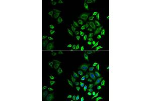 Immunofluorescence analysis of U2OS cell using PLA2G2D antibody. (PLA2G2D anticorps)