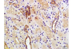 Formalin-fixed and paraffin embedded human kidney labeled with Anti-Plakophilin 2 Polyclonal Antibody, Unconjugated (ABIN1386389) at 1:200 followed by conjugation to the secondary antibody and DAB staining (Plakophilin 2 anticorps  (AA 801-881))