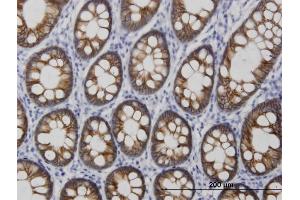 Immunoperoxidase of monoclonal antibody to CDH17 on formalin-fixed paraffin-embedded human colon. (LI Cadherin anticorps  (AA 24-131))