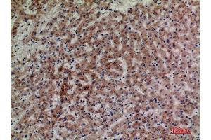 Immunohistochemistry (IHC) analysis of paraffin-embedded Human Liver, antibody was diluted at 1:100.