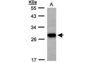 WB Image Sample(30 ug whole cell lysate) A: H1299 12% SDS PAGE antibody diluted at 1:500 (TSPAN1 anticorps  (C-Term))