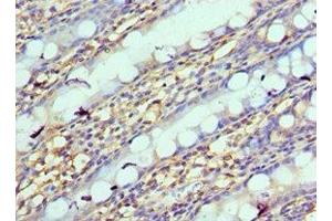 Immunohistochemistry of paraffin-embedded human colon tissue using ABIN7161635 at dilution of 1:100