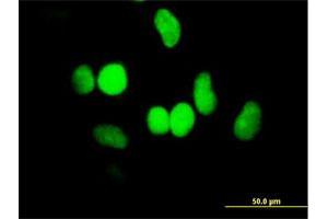 Immunofluorescence of purified MaxPab antibody to HELLS on HeLa cell.