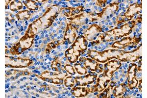ABIN6265723 and ABIN6267021 at 1/100 staining Mouse kidney tissue by IHC-P.