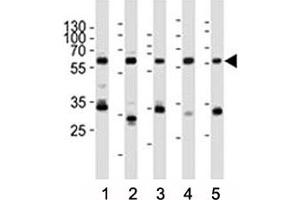 Western blot analysis of lysate from (1) HeLa, (2) rat PC-12, (3) Ramos, (4) mouse NIH3T3 cell line, (5) mouse brain tissue lysate using Pyruvate Kinase/ PKM2 antibody at 1:1000. (PKM2 anticorps  (AA 476-505))