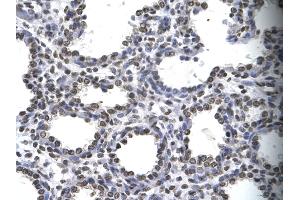 Human Lung; . (MYEF2 anticorps  (Middle Region))