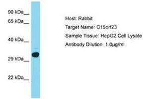 Image no. 1 for anti-Kinetochore-Localized Astrin/SPAG5 Binding Protein (KNSTRN) (AA 151-200) antibody (ABIN6750719) (KNSTRN anticorps  (AA 151-200))