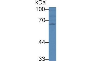 Detection of RANk in Human 293T cell lysate using Polyclonal Antibody to Receptor Activator Of Nuclear Factor Kappa B (RANk) (TNFRSF11A anticorps  (AA 359-542))