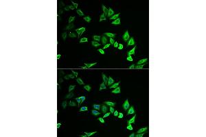 Immunofluorescence analysis of U2OS cells using MYOZ2 antibody.