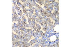 Immunohistochemistry of paraffin-embedded rat liver using FAH antibody at dilution of 1:100 (x40 lens). (FAH anticorps)