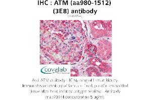 Image no. 1 for anti-Ataxia Telangiectasia Mutated (ATM) (AA 980-1512) antibody (ABIN1723092) (ATM anticorps  (AA 980-1512))