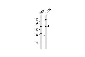 All lanes : Anti-AVPR2 Antibody (C-term) at 1:2000 dilution Lane 1: Hela whole cell lysates Lane 2: Jurkat whole cell lysates Lysates/proteins at 20 μg per lane. (AVPR2 anticorps  (C-Term))