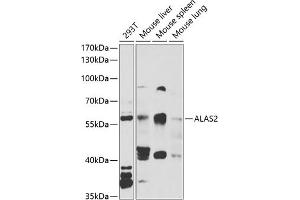 Western blot analysis of extracts of various cell lines, using  antibody (ABIN6129839, ABIN6136757, ABIN6136758 and ABIN6222179) at 1:1000 dilution.