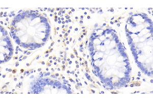 Detection of S100A12 in Human Colon Tissue using Polyclonal Antibody to S100 Calcium Binding Protein A12 (S100A12)