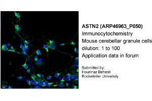 Immunocytochemistry --Sample Type: Mouse cerebellar granule cellsDilution: 1:100 (Astrotactin 2 anticorps  (N-Term))