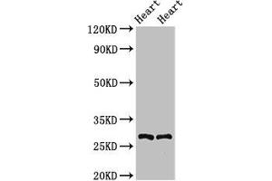 Western Blot Positive WB detected in: Rat heart tissue, Mouse heart tissue All lanes: MYF5 antibody at 2. (MYF5 anticorps  (AA 1-255))
