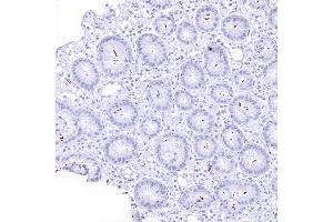 A moderate number of helicobacter pylori in a stomach sample (Helicobacter Pylori anticorps  (AA 323-445))