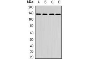 Western blot analysis of CENP-C expression in A431 (A), HepG2 (B), mouse brain (C), rat brain (D) whole cell lysates. (CENPC1 anticorps)