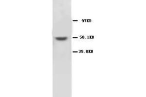 MMP16 Polyclonal Antibody (MMP16 anticorps  (C-Term))