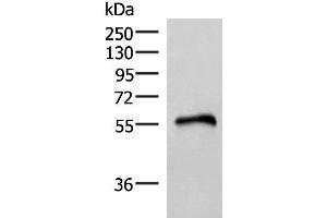 Western blot analysis of Human heart tissue lysate using RETREG1 Polyclonal Antibody at dilution of 1:400 (FAM134B anticorps)