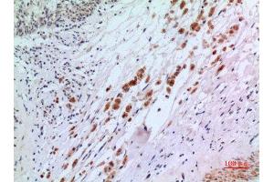 Immunohistochemistry (IHC) analysis of paraffin-embedded Human Brain, antibody was diluted at 1:100. (IFN-AlphaR2 (N-Term) anticorps)