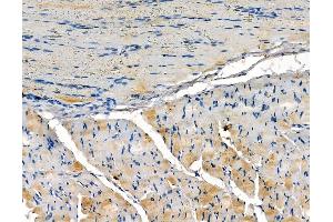 ABIN6259481 and ABIN6273812 at 1/100 staining rat muscle tissue by IHC-P.