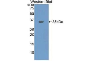 Western Blotting (WB) image for anti-Oxidized Low Density Lipoprotein (Lectin-Like) Receptor 1 (OLR1) (AA 51-314) antibody (ABIN1859679) (OLR1 anticorps  (AA 51-314))