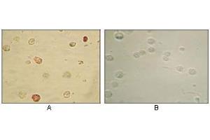 Immunocytochemistry analysis of TPA induced BCBL-1 cells (A) and uninduced BCBL-1 cells (B) using KSHV ORF45 antibody with AEC staining. (KSHVORF45 anticorps)