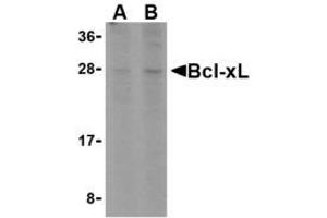Image no. 1 for anti-BCL2-Antagonist/killer 1 (BAK1) (N-Term) antibody (ABIN206321) (BAK1 anticorps  (N-Term))