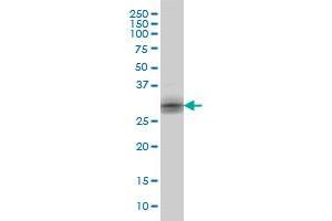 KLK8 monoclonal antibody (M01), clone 2F11 Western Blot analysis of KLK8 expression in A-431 .