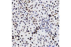 Immunohistochemistry of paraffin-embedded rat kidney tissue, using HMGB1 antibody. (HMGB1 anticorps)