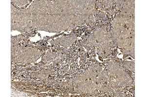 IHC analysis of WFS1 using anti-WFS1 antibody (ABIN7602165).