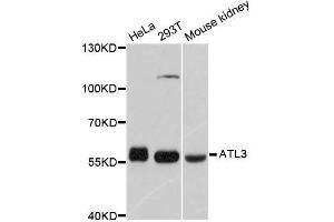 Western blot analysis of extracts of various cell lines, using ATL3 antibody. (ATL3 anticorps  (AA 360-440))